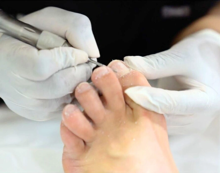 Medical Pedicure