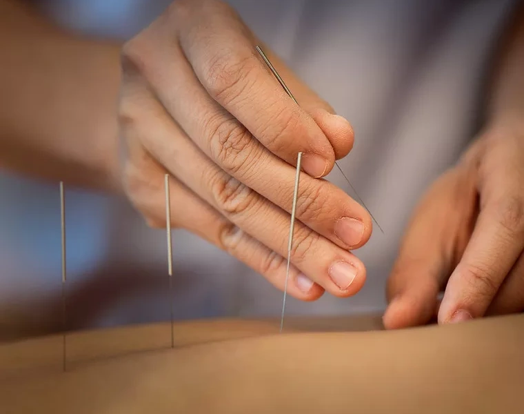 Modern Foot Acupunture