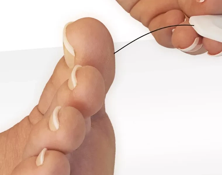 Diabetic Medical Pedicure